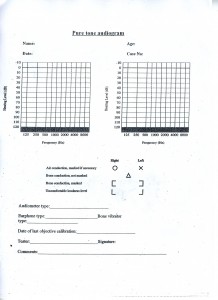 pure tone audiogram