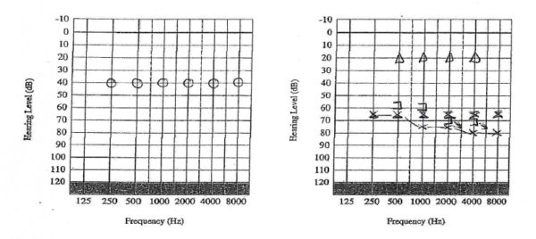 Rule 3 Masking Graph Example Rule 3 explained? Masking Training with TJ Audiology Training – TJ ...
